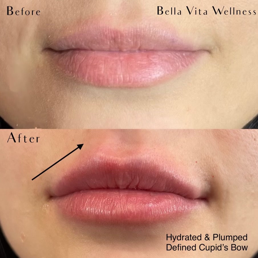 Image Title Alt Image