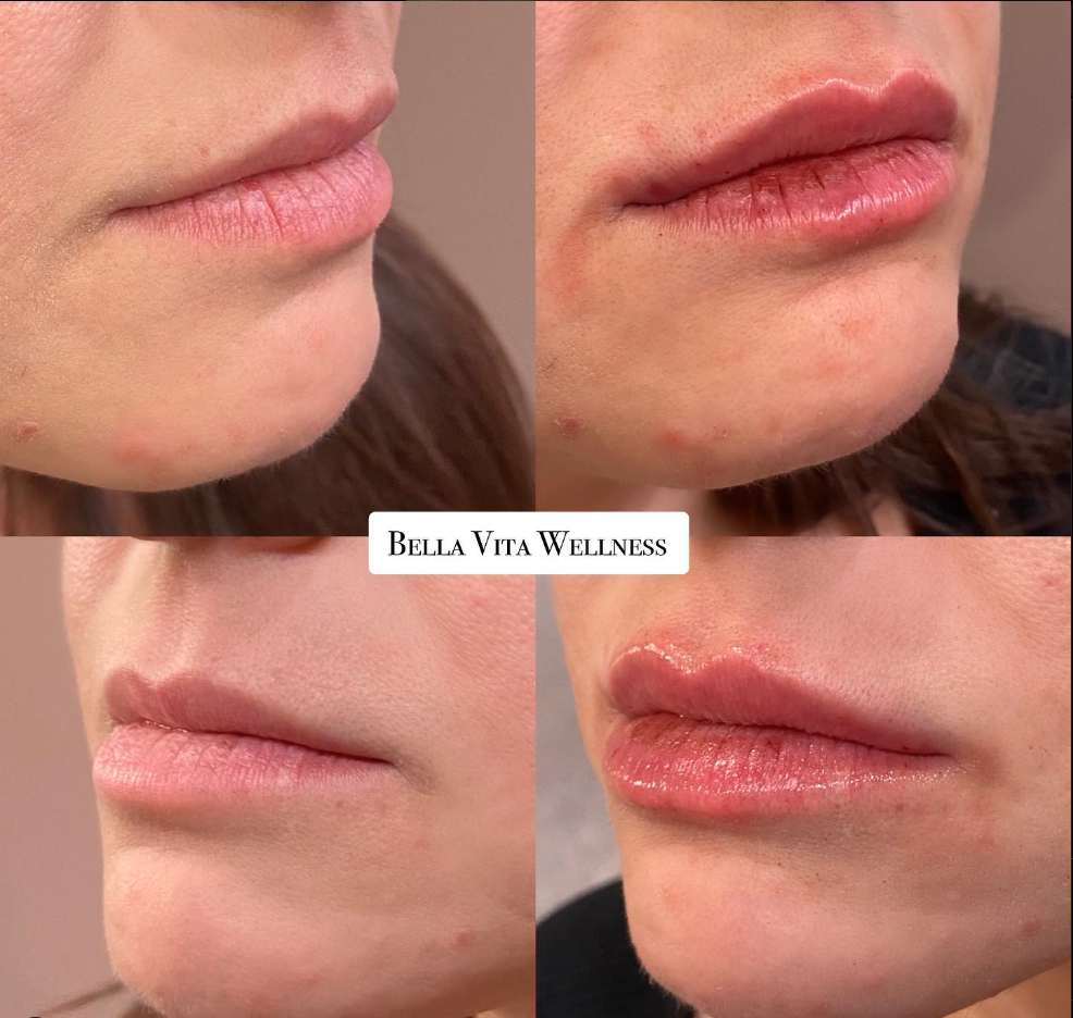 Image Title Alt Image